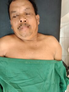 Diduga Bertengkar Soal Lahan Kebun Kelapa Sawit, Manajer PT CAS Ditikam Warga Bandar Khalifah